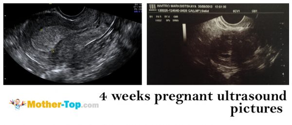 4 weeks pregnant ultrasound pictures