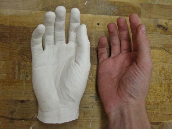 Изготовление гипсовой руки